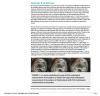 Comparison of Clinical and Radiological Results of Lateral Retinacular Release or Lateral Retinacular Lengthening Methods Combined With Medial Retinaculum Plication in Patellofemoral Instability