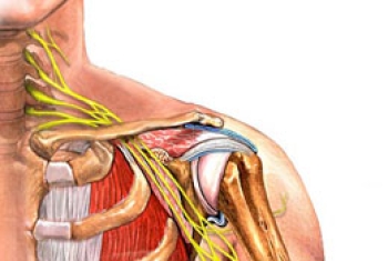 Luxatio erecta humeri :reporting a swimming injury with anaylyzing the mechasim of inury in literature.